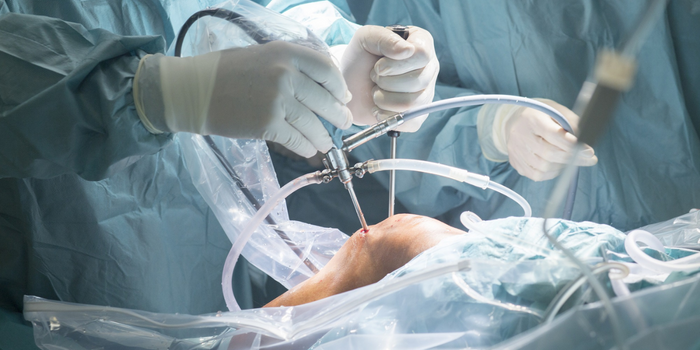 Best arthroscopic surgeon in chennaib